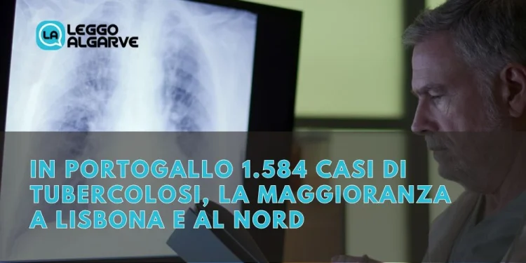 Un medico esamina un'immagine a raggi X dei polmoni dopo i casi di tubercolosi registrati in Portogallo. Il testo sovrapposto recita: "Casi Tubercolosi Portogallo: 1.584 casi, la maggioranza a Lisbona e al nord".